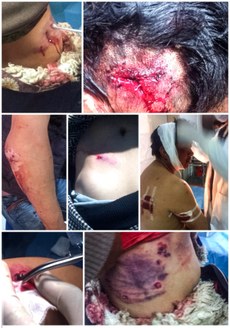 Tibetan-protesters-in-Sershul-suffering-gunshot-wounds.jpg